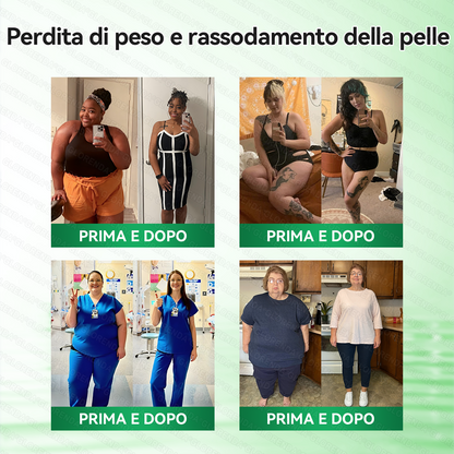 🇮🇹Store Ufficiale Slimora® Moringa · Berberina × NAD+ microneedle nano