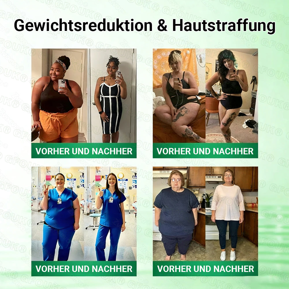 Offizieller 🇩🇪  Moringa · Berberin × NAD+ 10-in-1 Nano Mikronadel-Patch 🇩🇪