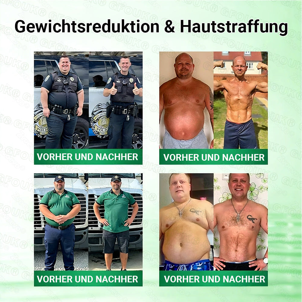 Offizieller 🇩🇪  Moringa · Berberin × NAD+ 10-in-1 Nano Mikronadel-Patch 🇩🇪